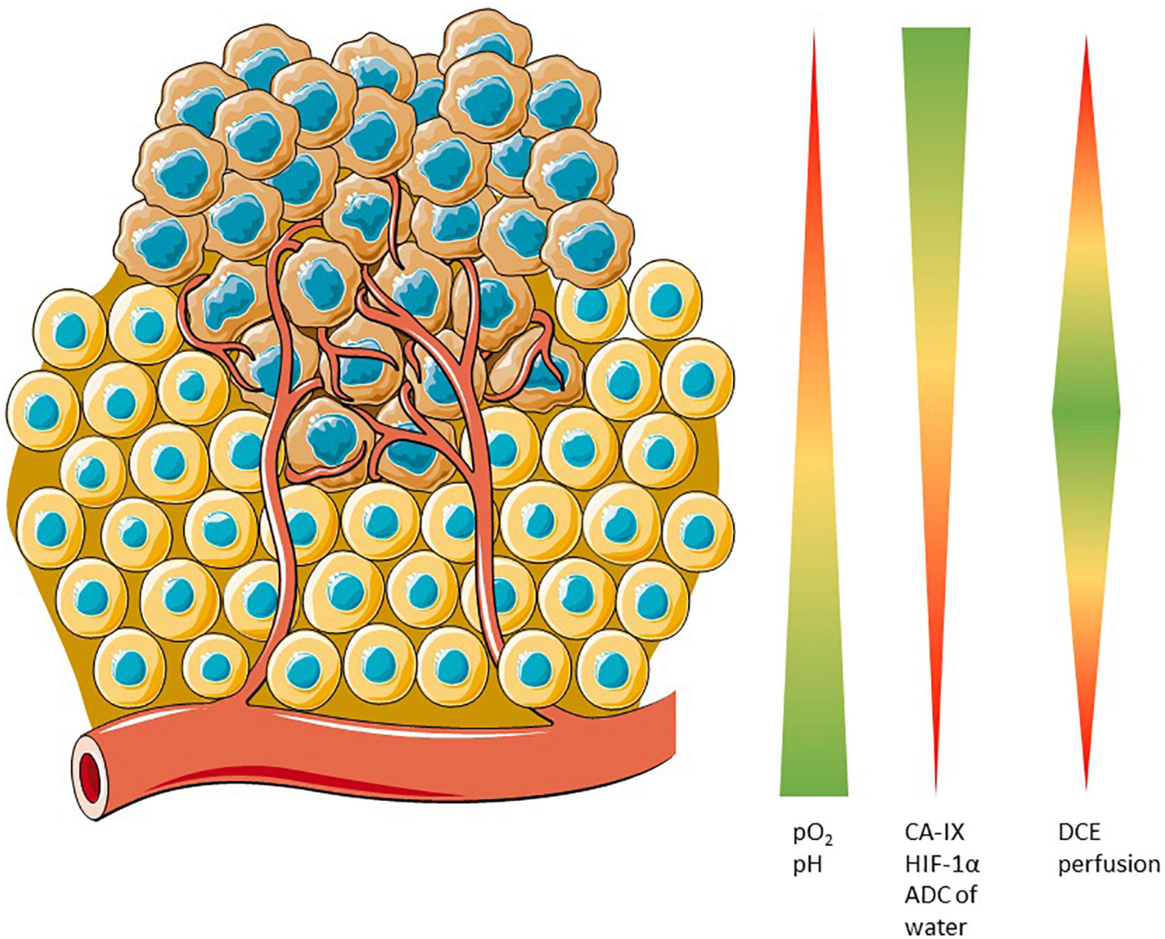 Advances in PET and MRI imaging of tumor hypoxia